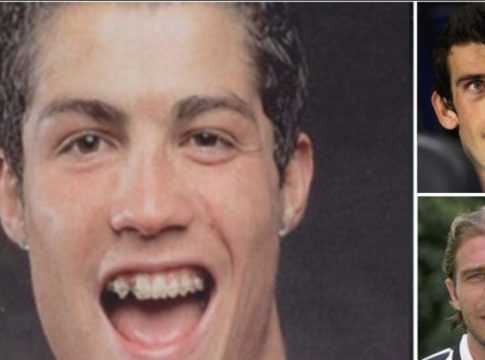 Πριν και μετά: 11 αστέρες του ποδοσφαίρου που έγιναν άλλοι άνθρωποι (pics)