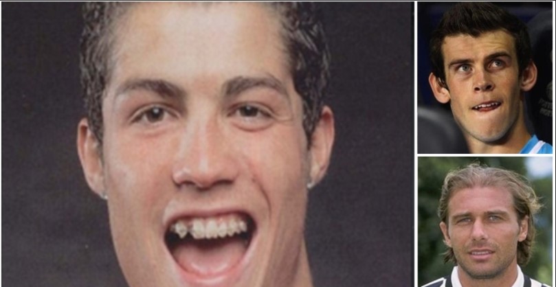 Πριν και μετά: 11 αστέρες του ποδοσφαίρου που έγιναν άλλοι άνθρωποι (pics)
