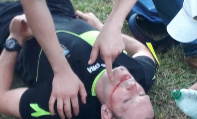Αργεντινή: Αγριος ξυλοδαρμός διαιτητή από παίκτη! (vid)