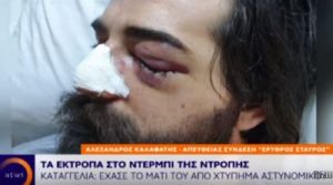 Όταν ένα κομμένο μάτι, μετρά λιγότερο από καρέκλες και μολότοφ