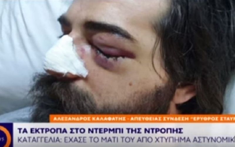 Όταν ένα κομμένο μάτι, μετρά λιγότερο από καρέκλες και μολότοφ
