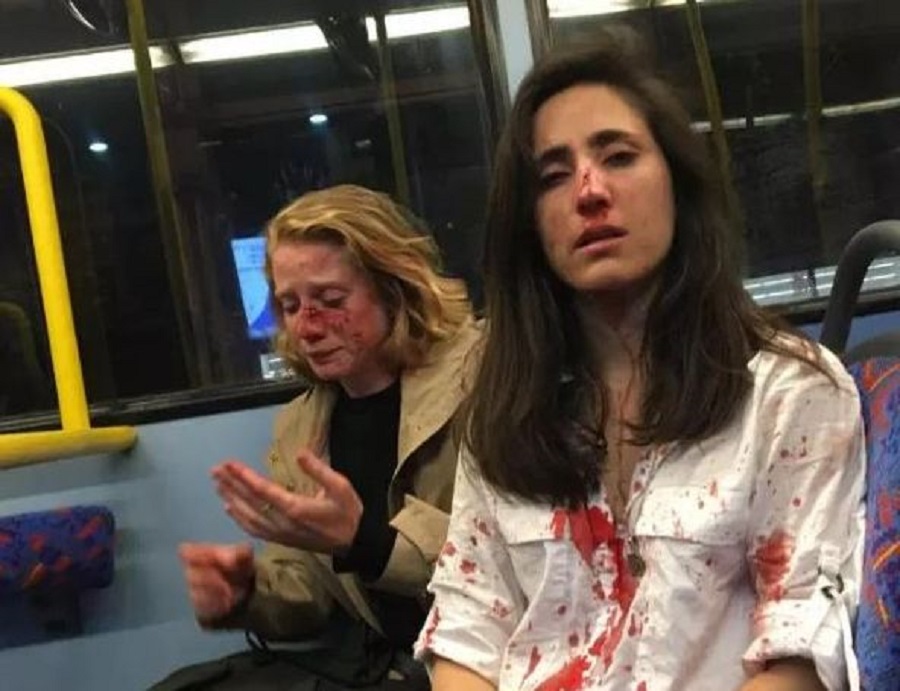 Άγριος ξυλοδαρμός γυναικών στο Λονδίνο: Τις έδειραν γιατί αρνήθηκαν να φιληθούν μπροστά τους