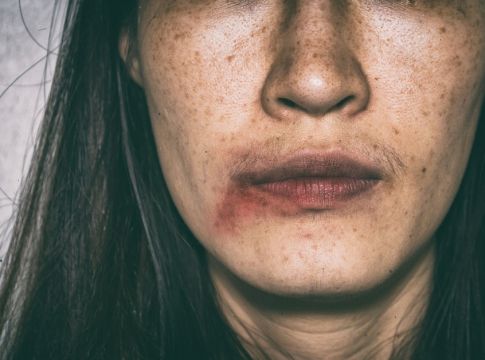 Ελληνίδα μοντέλο και παρουσιάστρια καταγγέλλει ξυλοδαρμό