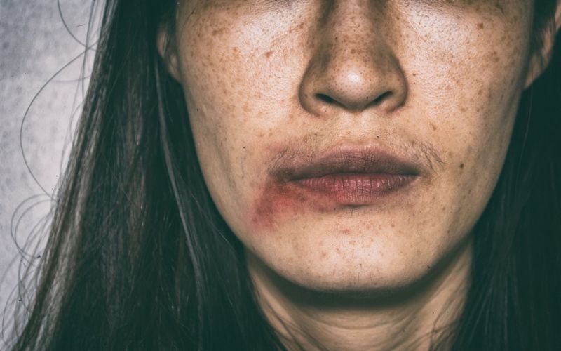 Ελληνίδα μοντέλο και παρουσιάστρια καταγγέλλει ξυλοδαρμό