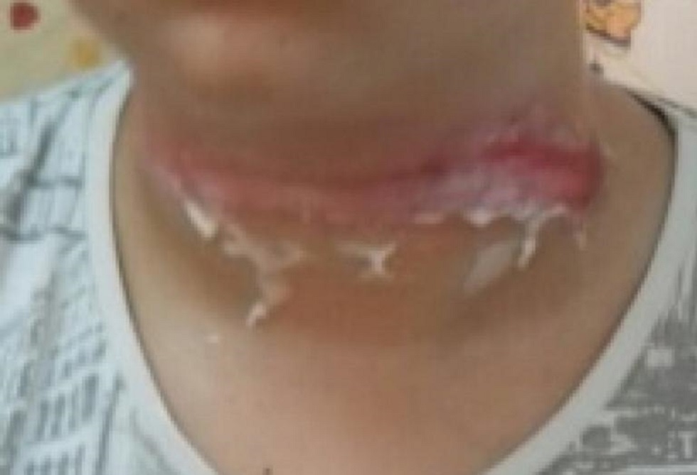 Ηράκλειο: Το σχοινί της παρέλασης παραλίγο να σκοτώσει 13χρονο παιδί – Το ξέσπασμα του πατέρα του (pics)