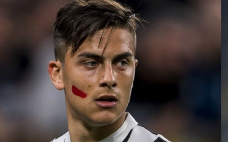 Serie A: Γιατί οι παίκτες έχουν κόκκινο σημάδι στο μάγουλο;