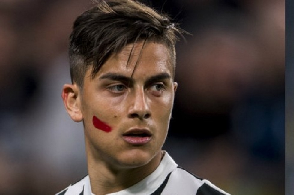 Serie A: Γιατί οι παίκτες έχουν κόκκινο σημάδι στο μάγουλο;