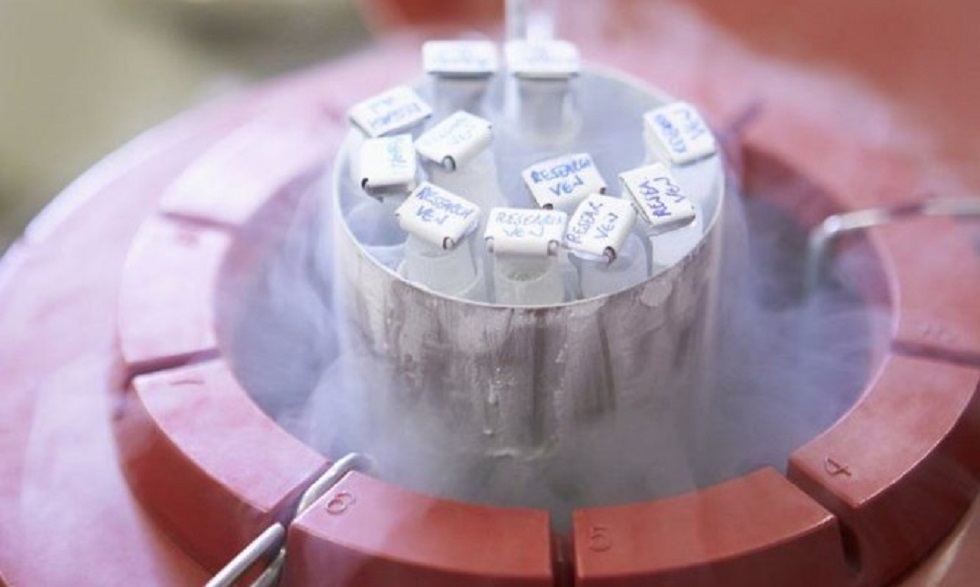 Κατάψυξη σπέρματος: Μέχρι πόσα χρόνια είναι εγγυημένη; Όλα όσα πρέπει να ξέρετε