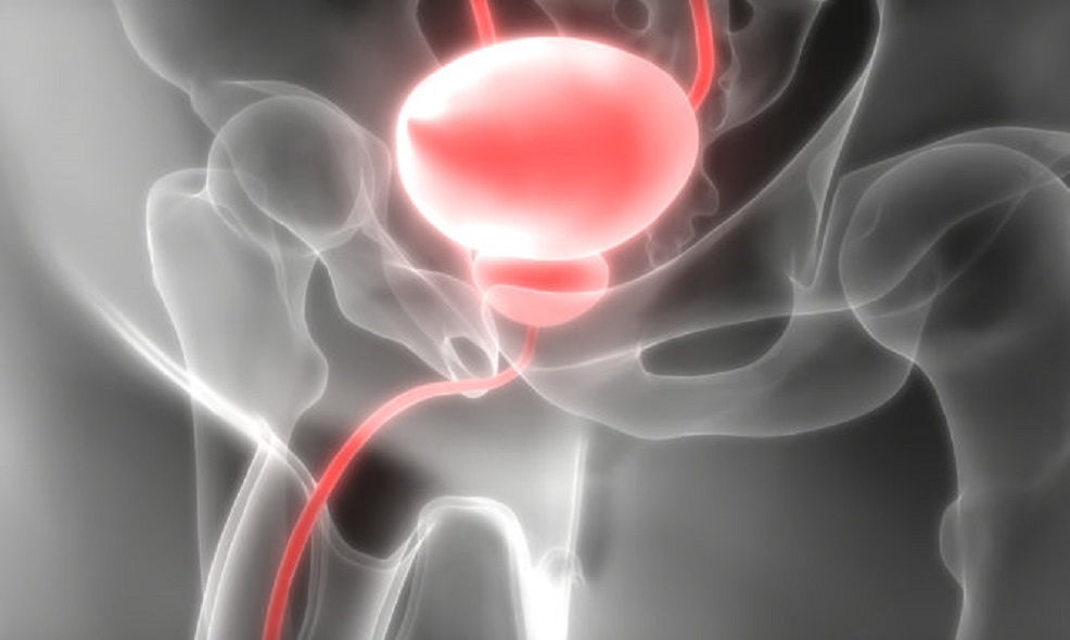 Καρκίνος του προστάτη: Τα πρώιμα συμπτώματα που πρέπει κάθε άντρας να γνωρίζει