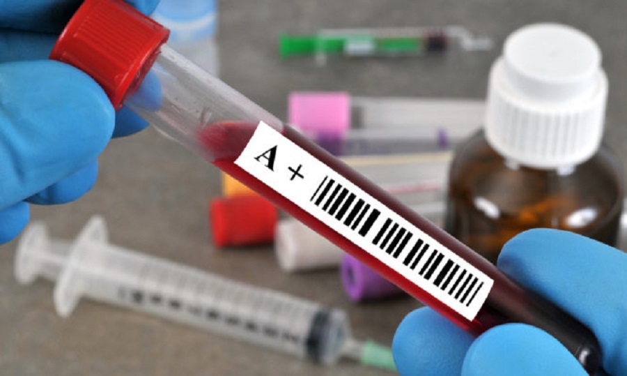 Κορωνοϊός: Η ομάδα αίματος ίσως επηρεάζει τον κίνδυνο – Νέα έρευνα