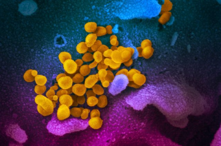 Κορωνοϊός: Έξι στους δέκα άνθρωποι κολλάνε τον ιό, δεν εμφανίζουν ποτέ συμπτώματα, αλλά τον μεταδίδουν κανονικά