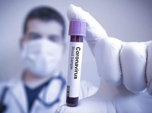 62 νεκροί στη Σουηδία αλλά δεν κλείνει τίποτα – Ανοιχτά όλα, εστιατόρια, σχολεία