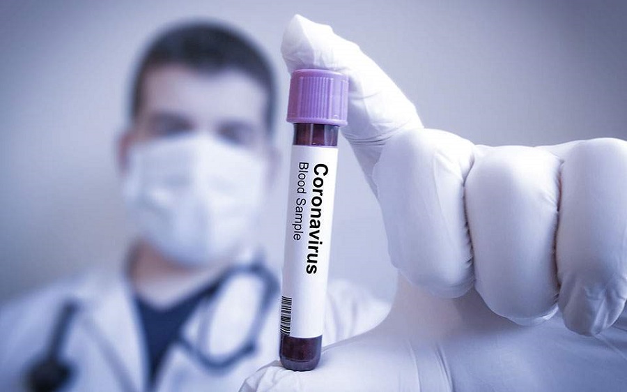 Κορωνοϊός: Ραγδαίες εξελίξεις – Σε λίγες μέρες τα πρώτα τεστ εμβολίου για τον άνθρωπο