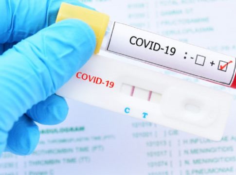 Κορονοϊός: Σχεδόν έτοιμο το ατομικό τεστ 15 λεπτών – Δείτε πώς θα το κάνουμε στο σπίτι