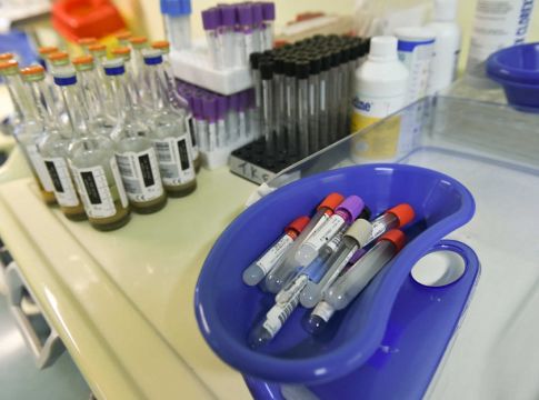 Κορονοϊός: Μεταδίδεται και έτσι! Ο τρόπος που δεν γνωρίζαμε