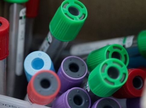Κορωνοϊός – Guardian: Η Βρετανία κυκλοφορεί εντός των ημερών τεστ κατ’ οίκον μέσω Amazon