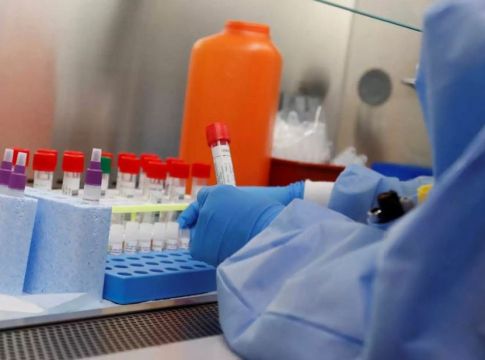 Προσοχή: Πως ξεχωρίζουμε τον κορονοϊό από την αλλεργία