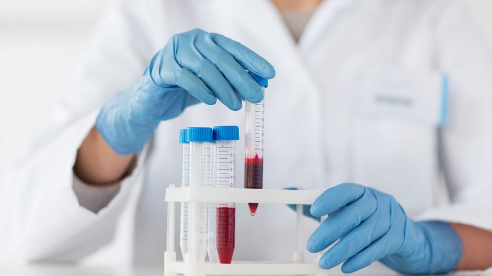 Κορωνοϊός : Ενθαρρυντικά τα δεδομένα θεραπείας με πλάσμα αίματος από ασθενείς που ανάρρωσαν