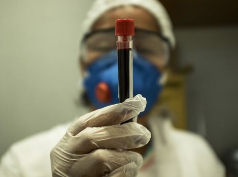 Ινστιτούτο Ρόμπερτ Κοχ: Πριν την περαιτέρω χαλάρωση του lockdown ο αριθμός των κρουσμάτων θα πρέπει να μειωθεί σε μερικές εκατοντάδες ημερησίως