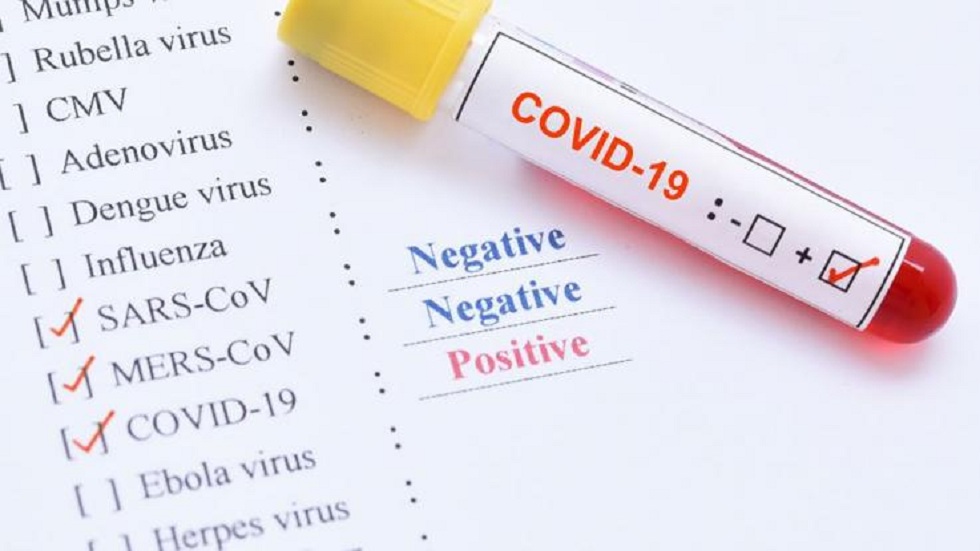 Κορωνοϊός: Νέα θεωρία για την προέλευσή του – Προήλθε από «ατύχημα» στην προσπάθεια να βρεθεί εμβόλιο για το AIDS;