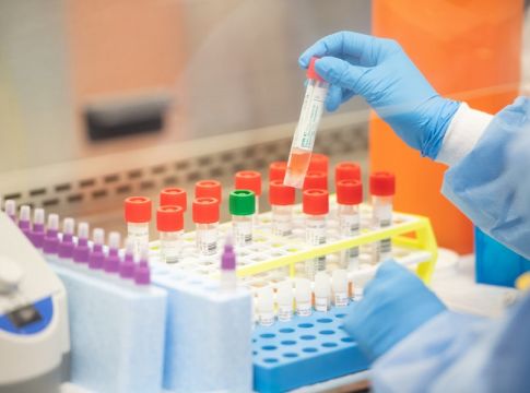 Πήρε έγκριση το πρώτο μοριακό τεστ ανίχνευσης κοροναϊού που μπορεί να γίνει στο σπίτι