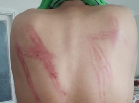 Ο κορωνοϊός έβαλε σε «καραντίνα» τα δικαιώματα των προσφύγων – Επαναπροωθήσεις, βία και ναζιστικές πρακτικές