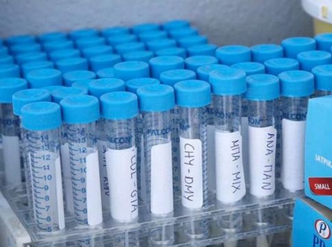 Κορονοϊός – Θετικά νέα! Ένα γρήγορο τεστ ανίχνευσης Covid-19 προτείνουν ερευνητές του «Δημόκριτου»