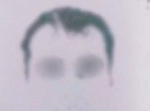 Ψευτογιατρός: Σοκάρουν οι καταγγελίες των θυμάτων του – Ο απατεώνας με τα χίλια πρόσωπα