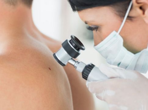 Κόκκινες ελιές στο δέρμα: Πότε βγαίνουν, ποιοι τύποι υπάρχουν και τι να προσέχετε