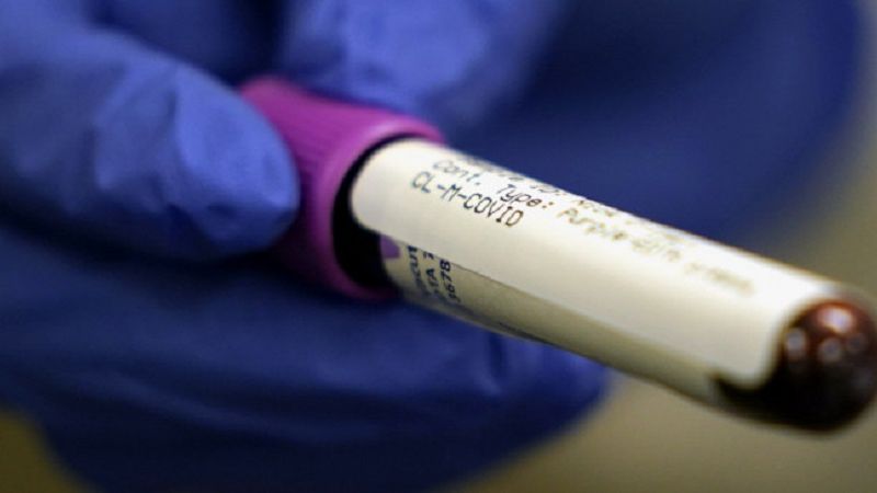 «Χρυσή» η ρεμδεσιβίρη – Για γερά πορτοφόλια το φάρμακο κατά του κορωνοϊού