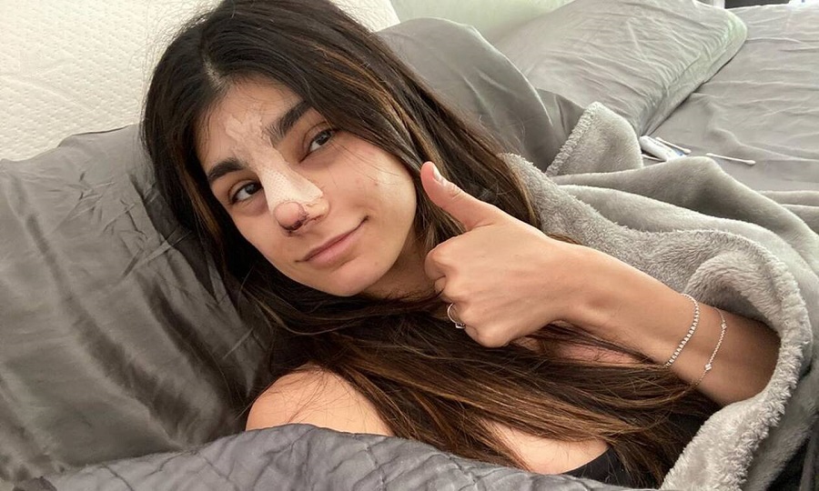 Άλλος άνθρωπος η Mia Khalifa! Η «νέα» της μύτη κόστισε… 15.000 δολάρια! (Photos)