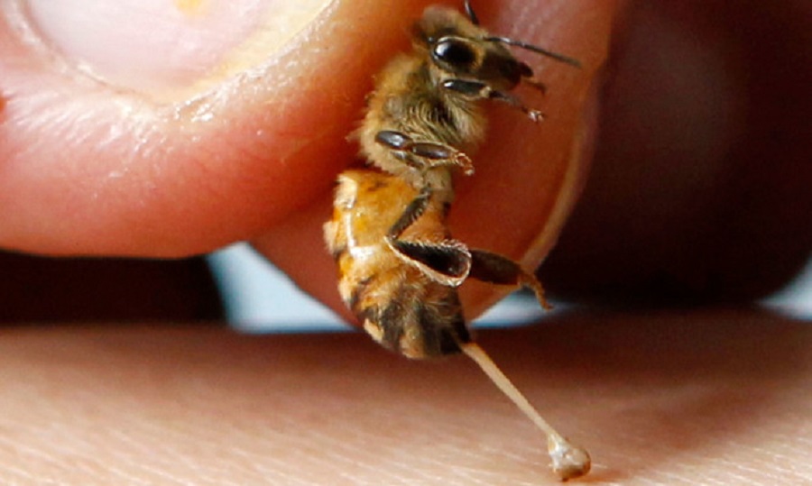 Τι κάνουμε αν μας τσιμπήσει μέλισσα ή σφήκα
