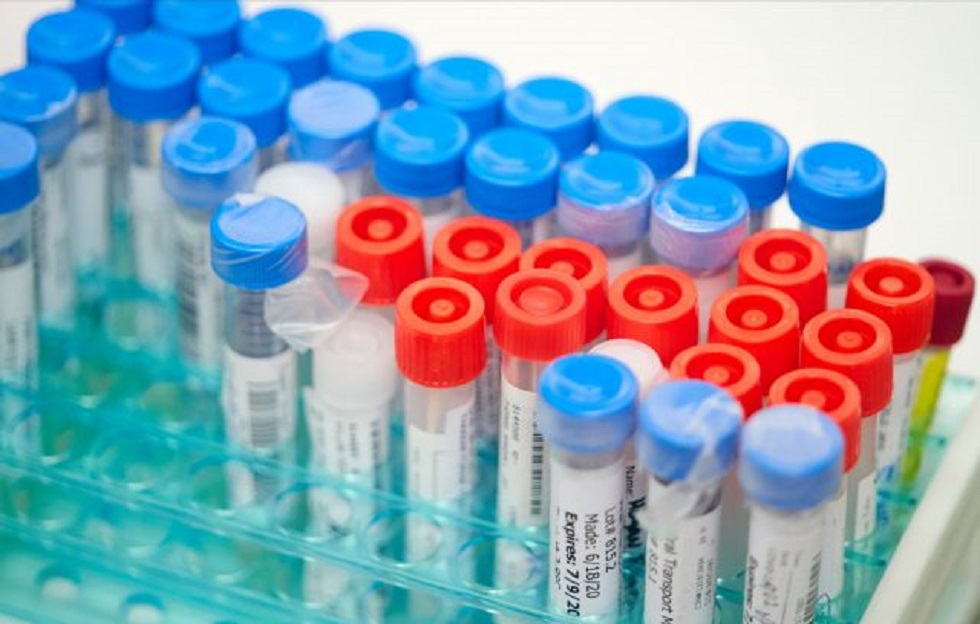 Ανησυχητικά στοιχεία για τις επιπτώσεις του κορωνοϊού στην ψυχική υγεία – Τι λένε οι ειδικοί