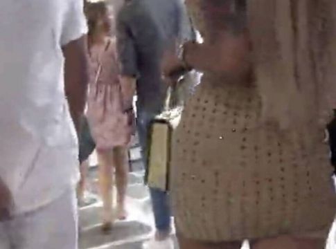 Μύκονος : Η Βραζιλιάνα με τις 50 επεμβάσεις που… χάζεψε το νησί (pics+vid)