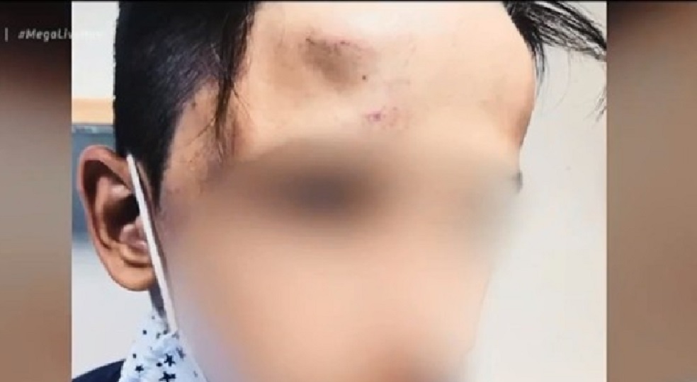 Συγκλονιστικές μαρτυρίες για τον ξυλοδαρμό 17χρονου στο Γαλάτσι – «Μετρούσαν τις κλωτσιές που του έριχναν»
