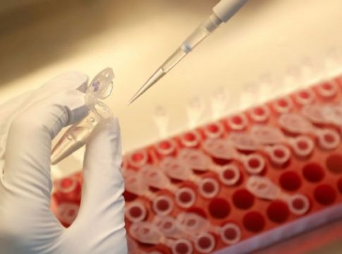 Κορωνοϊός : Στα 46 τα κρούσματα στο εργοστάσιο στα Γιαννιτσά – Σαρωτικοί έλεγχοι