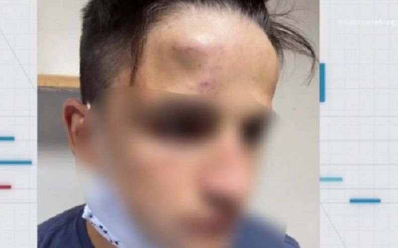 Ξυλοδαρμός 17χρονου στο Γαλάτσι : Συνελήφθησαν τέσσερις ανήλικοι
