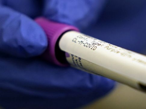 Ο κορωνοϊός σκοτώνει έναν άνθρωπο κάθε 16 δευτερόλεπτα
