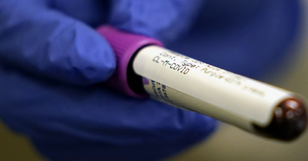 Εμβόλιο Pfizer : Τα επόμενα βήματα – Πόσες δόσεις θα πάρει η Ελλάδα