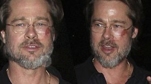 Ματωμένος Brad Pitt – Τον γύρο του κόσμου κάνουν οι φωτογραφίες του (pic+vid)