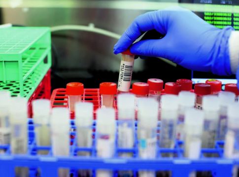 Εντείνεται η παγκόσμια ανησυχία για τη μετάλλαξη Δέλτα – Σε ποιες χώρες κυριαρχεί, τι φοβούνται οι ειδικοί