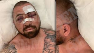 Σωματοφύλακας Νταν Μπιλζέριαν: «Eίμαι τυχερός που ζω, με λιθοβολούσαν με μεγάλες πέτρες»