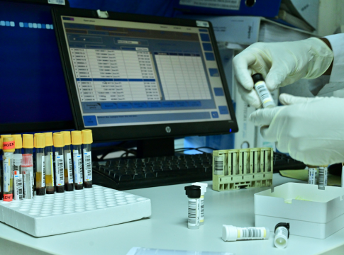 WADA – Αφαίρεσε την πιστοποίηση του εργαστηρίου αντιντόπινγκ της Αθήνας