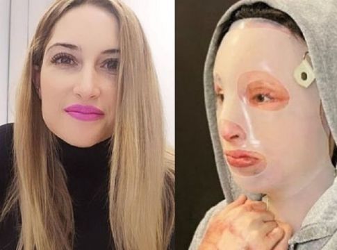 Συγκλονίζει η εξομολόγηση της Ιωάννας – «Θα πάω στο δικαστήριο για να με κοιτάξει όπως όταν μου έριξε το βιτριόλι»
