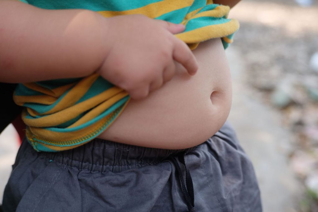 Η Ελλάδα τρίτη στην Ευρώπη σε παιδική παχυσαρκία – Ποιες περιφέρειες έχουν την αρνητική πρωτιά