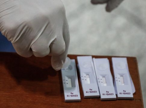 ΕΟΔΥ – Πού μπορείτε να κάνετε δωρεάν rapid test την Τρίτη 23 Νοεμβρίου