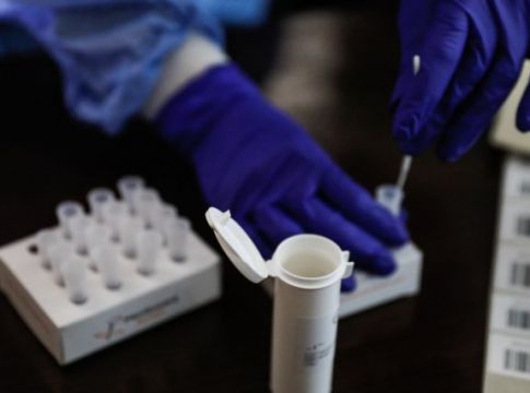 Συνεχίζεται ο «πόλεμος» των PCR – Πέντε σωματεία εξηγούν γιατί δεν είναι πιο φθηνά στην Ελλάδα