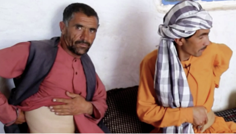 Πωλούν τα νεφρά τους για να ξεπληρώσουν χρέη –  Η φτώχεια οδηγεί τους Αφγανούς στο εμπόριο οργάνων