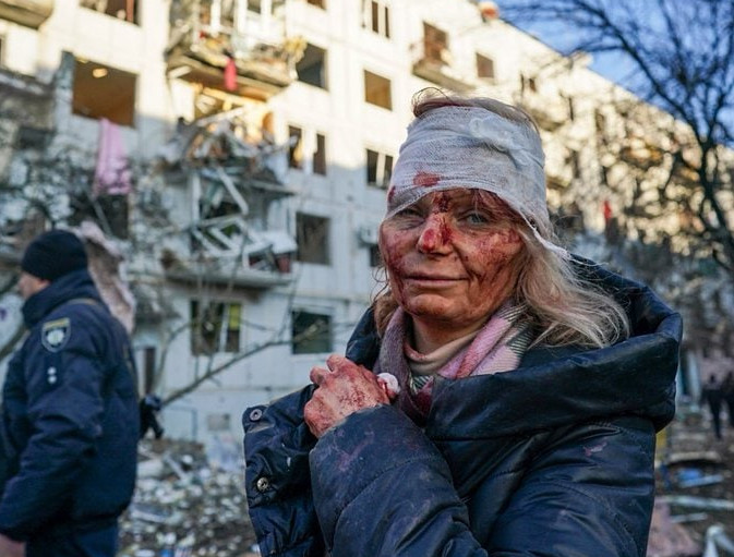 Το πικρό χαμόγελο του πολέμου – Η φωτογραφία που συγκλονίζει τον πλανήτη