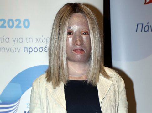 Ιωάννα Παλιοσπύρου: «Ήρθε η ώρα να ξανασυστηθούμε» – Δείχνει το πρόσωπό της χωρίς τη μάσκα